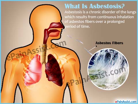 what-asbestosis